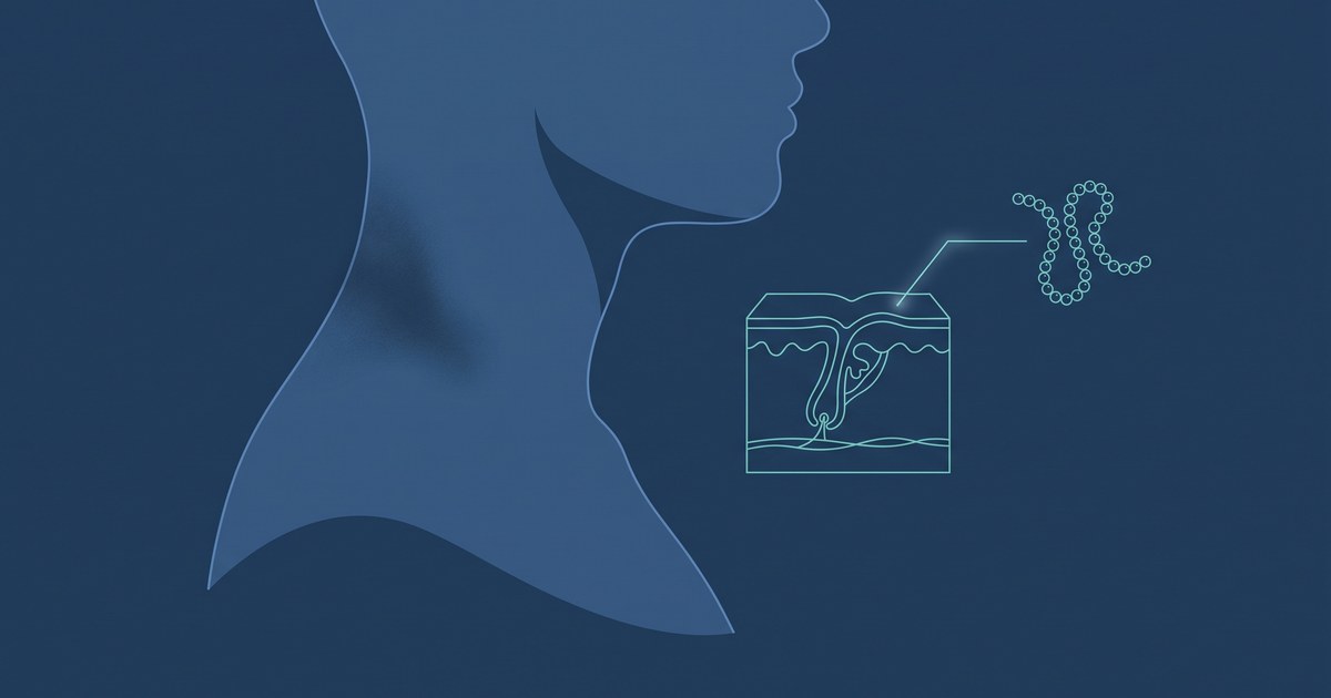 Ilustração editorial em tons de azul-marinho mostrando a silhueta de um pescoço de perfil, com uma área de textura aveludada mais escura na lateral e na nuca, ao lado de um corte esquemático da pele ligado por uma linha a uma cadeia de esferas que representa a molécula de insulina.
